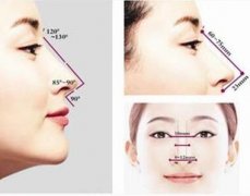 关于鼻尖整形的有分析和剖析。