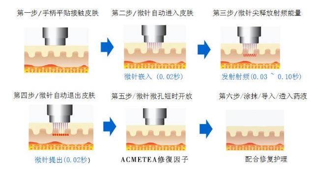 微针的作用