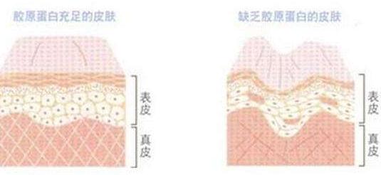 注射胶原蛋白有危害吗？