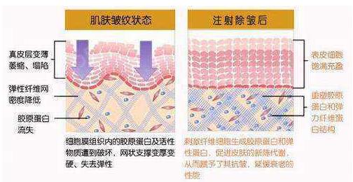 注射胶原蛋白的果