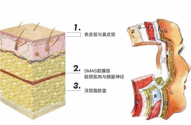 边缘比较倾斜，末端比较锋利的线除皱是啥？给你杜绝皱褶没苦恼