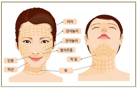 了解到韩国面部提升在当地很火，详细讲解一下这个手术！