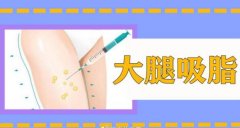 涨知识|大腿吸脂手术恢复期多久？