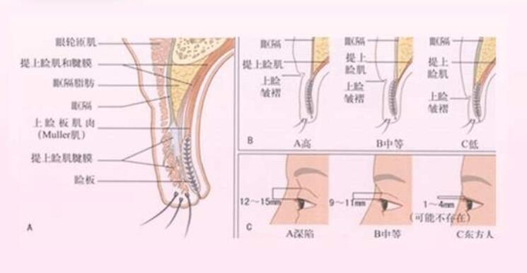 眼睛整形要多少钱？眼部综合整形手术能改良的问题