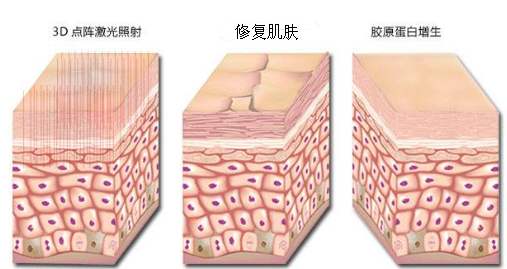 怎么去除痘印痘疤？网上方法太多你可以只认准这一种