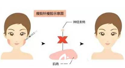 感受一下注射美容术的强大功