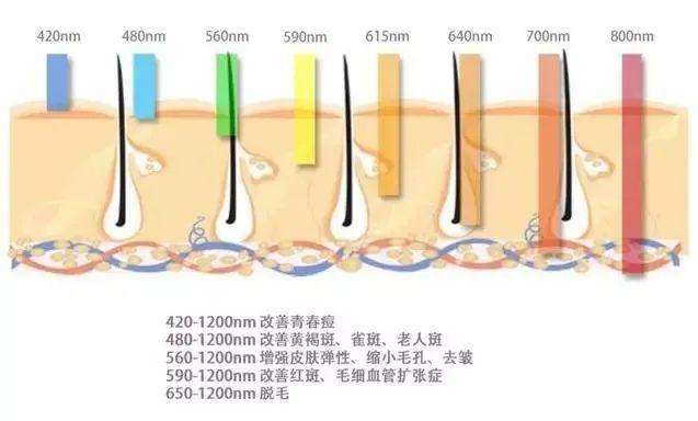 光子调节痤疮需要几次？术后注意事项