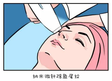 ]眼部除皱