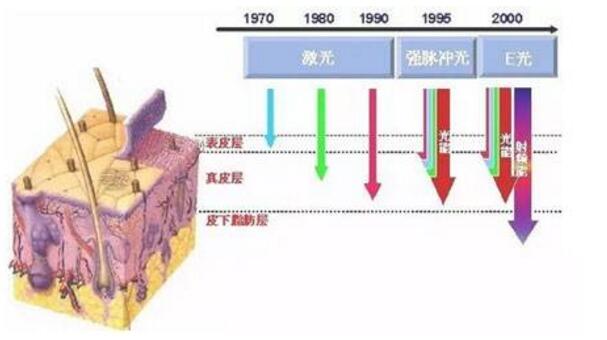 激光去除红血丝