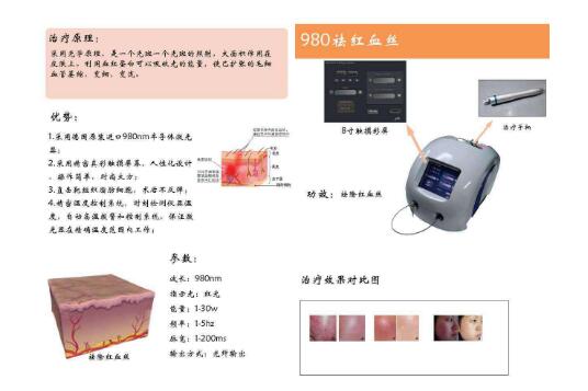 激光去除红血丝