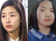 韩国整容高居在第一位 林珍娜明星变脸的全过程