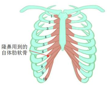 隆鼻不想做肋软骨还能选什么方案？看上海九院刘凯怎么说