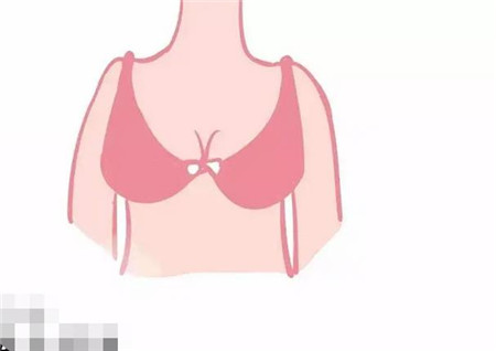 假体隆胸需要多长时间才能按摩?