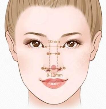 鼻翼缩小手术会留下疤痕吗?鼻翼整容前需要注意什么?