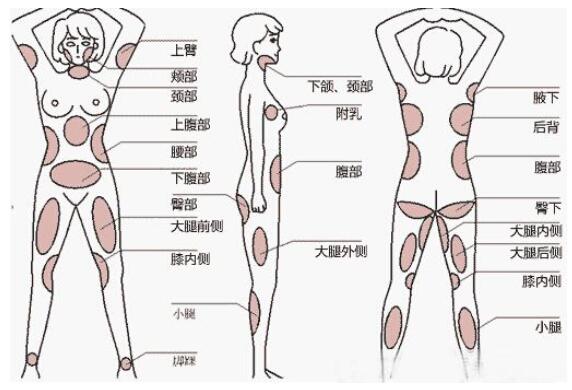 全身抽脂减肥价格大概要多少钱?