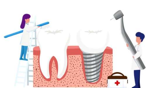 了解种植牙的过程：局部麻醉、种植体安装和牙冠修复等环节解析