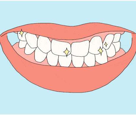 成人牙齿缝隙大怎么修复？常见的牙齿缝隙修复方法和注意事项