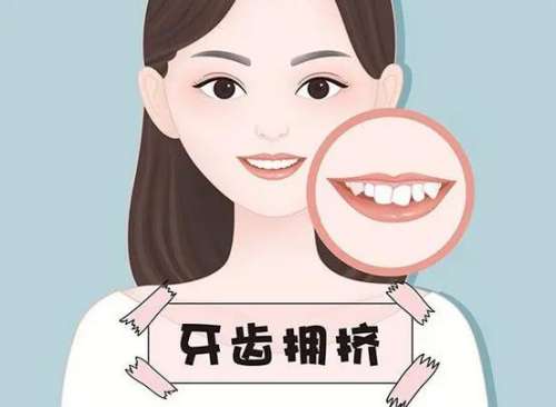 龅牙矫正方法有哪些？是否必须拔除四颗牙齿？