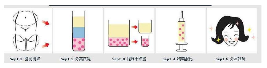 自体脂隆鼻的果能维持多久？