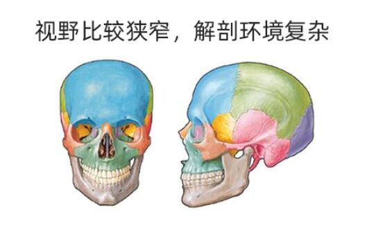 下颌角磨骨手术存在哪些风险性?