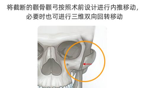 后遗症有哪些?