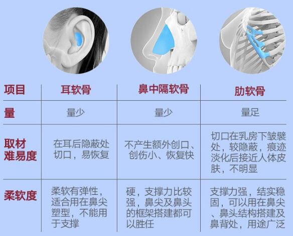 自体软骨移植隆鼻术没问题吗？揭开手术真相的面纱……