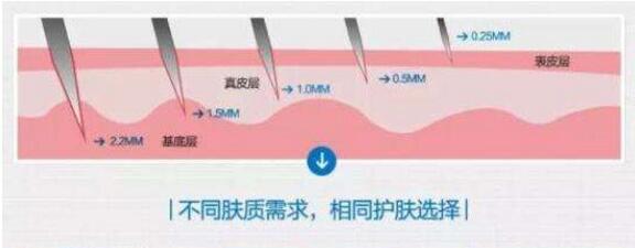 微针毁容后还能修复吗？美容不当致毁容你需要知道真相！